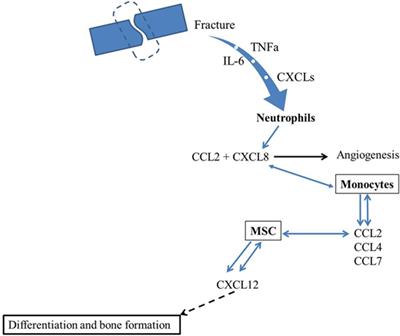 Potential Role of Chemokines in Fracture Repair